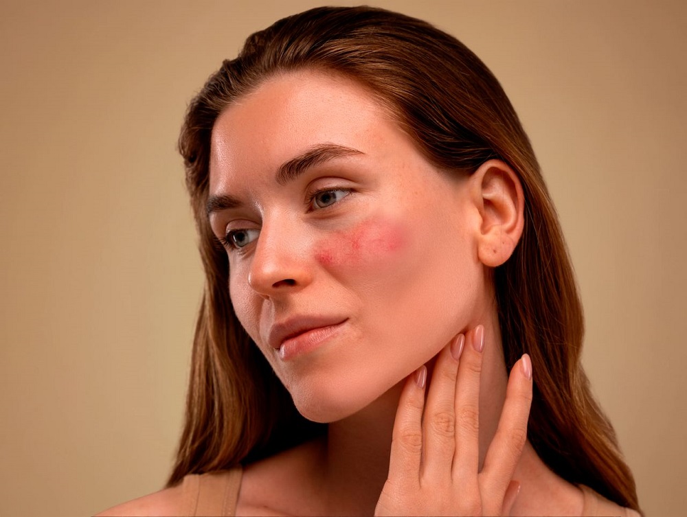 Удаление купероза